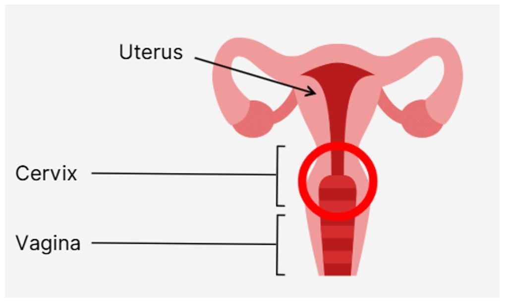 Cervix.JPG