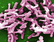 C. difficile micrograph