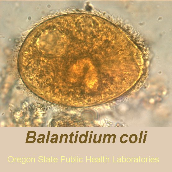 Balantidium image