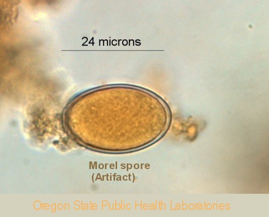 Morel spore