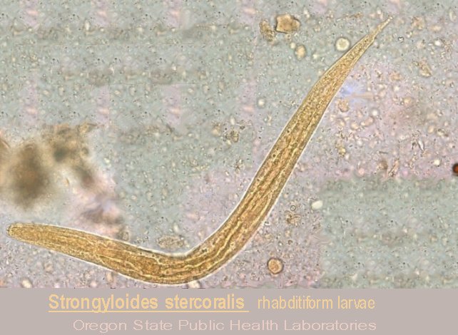 Strongyloides stercoralis