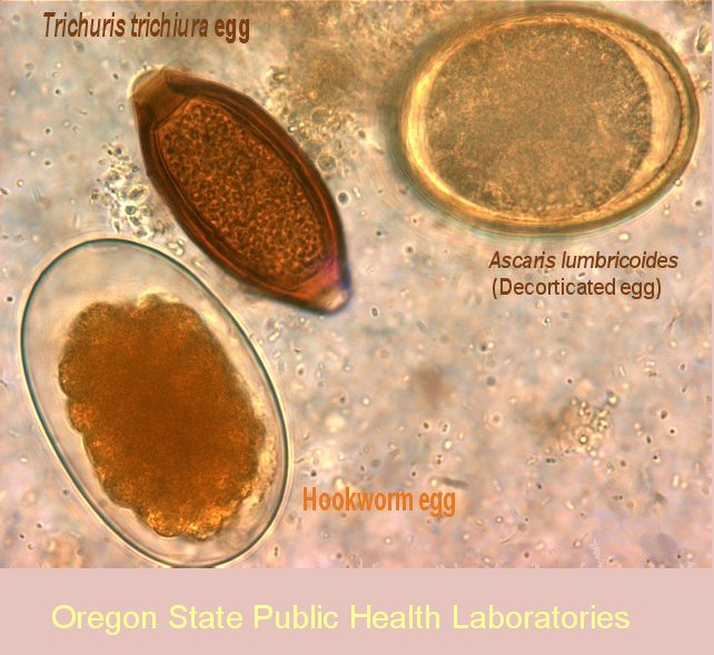 Roundworm egg comparison