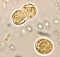 Blastocystis hominis image