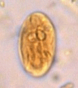Wet mount cyst Giardia lamblia image