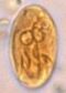 Giardia lamblia cyst wet mount image