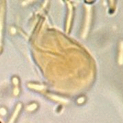 Wet mount trophozoite - Giardia lamblia