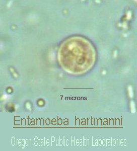 Entamoeba hartmanni Image