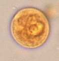 Entamoeba histolytica/dispar image