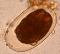 Hookworm egg