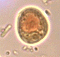 Iodamoeba buetschlii image
