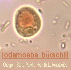 Iodamoeba beutschlii image