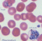 Plasmodium vivax